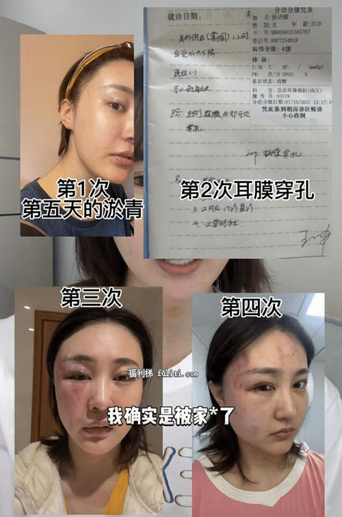 网红徐大宝被家暴事件是怎么回事？徐大宝为什么被打