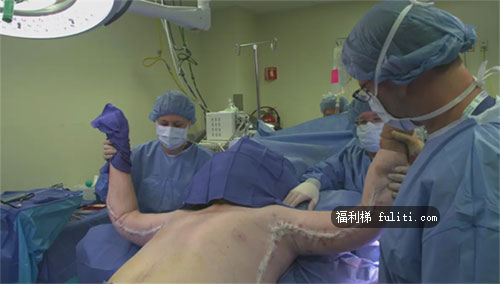 世界上最胖的人:重达1016斤 医生:死后火化要去屠宰场
