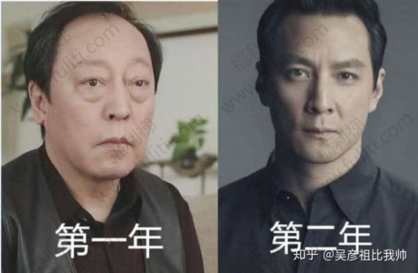 知乎问题精选:男生如何养成一张干干净净的脸?